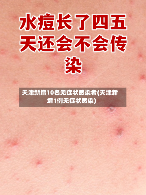 天津新增10名无症状感染者(天津新增1例无症状感染)