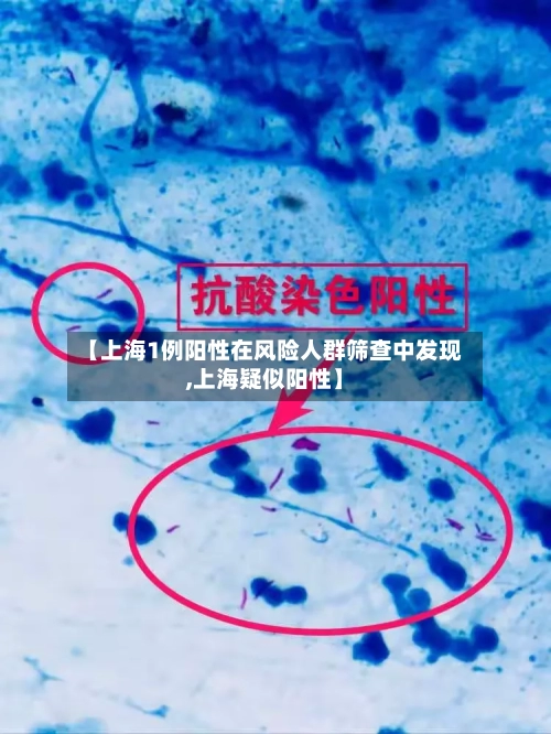 【上海1例阳性在风险人群筛查中发现,上海疑似阳性】-第2张图片