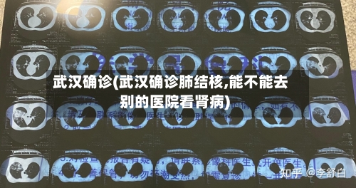武汉确诊(武汉确诊肺结核,能不能去别的医院看肾病)-第2张图片